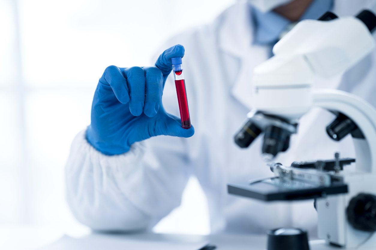 Doctor hand taking a blood sample tube from a rack with machines of analysis in the lab background, Technician holding blood tube test in the research laboratory.